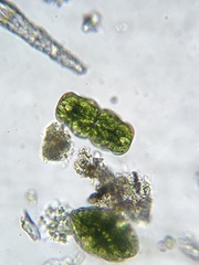 Micrasterias truncata