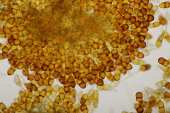Puccinia asparagi