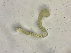 Racomitrium ericoides