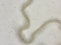 Racomitrium ericoides