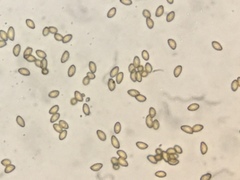 Phlegmacium variosimile