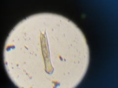 Gastrotricha