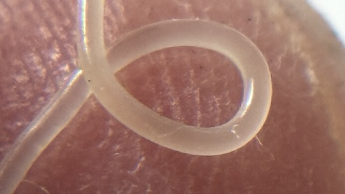 Anisakis, 2025-08-24