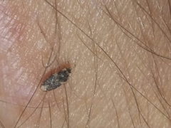 Parapiesma cinereum