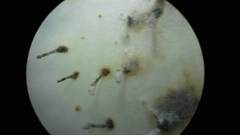 Doratomyces