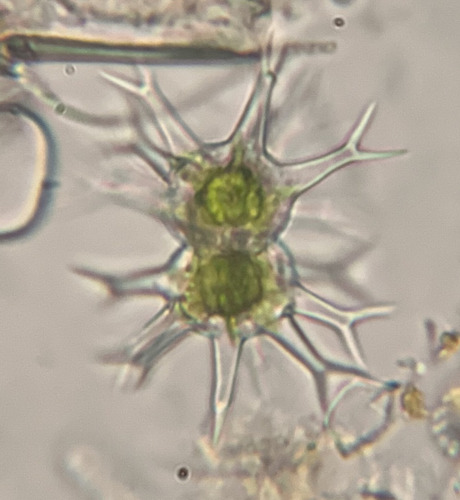 Staurastrum leptacanthum