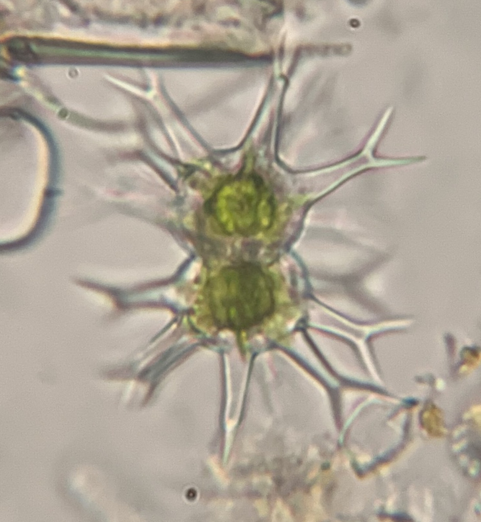 Staurastrum leptacanthum