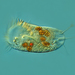 Ciliates - Photo (c) Proyecto Agua, some rights reserved (CC BY-NC-SA)