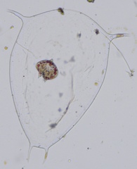 Protoperidinium