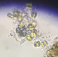 Scenedesmaceae