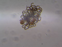 Dolichospermum lemmermannii