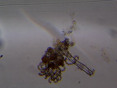 Dolichospermum lemmermannii