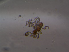 Dolichospermum lemmermannii