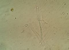 Periantria frullaniae