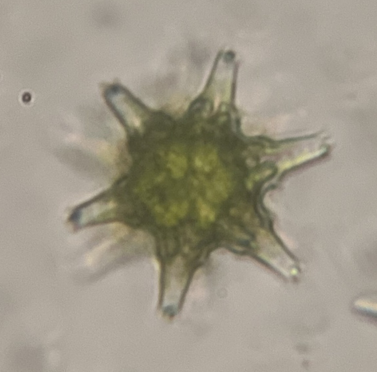 Staurastrum pinnatum var. reductum