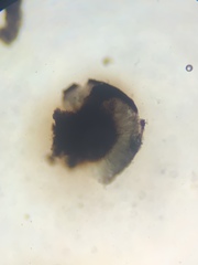 Rhizocarpon lavatum