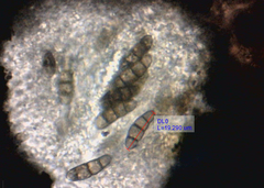 Hysterium acuminatum