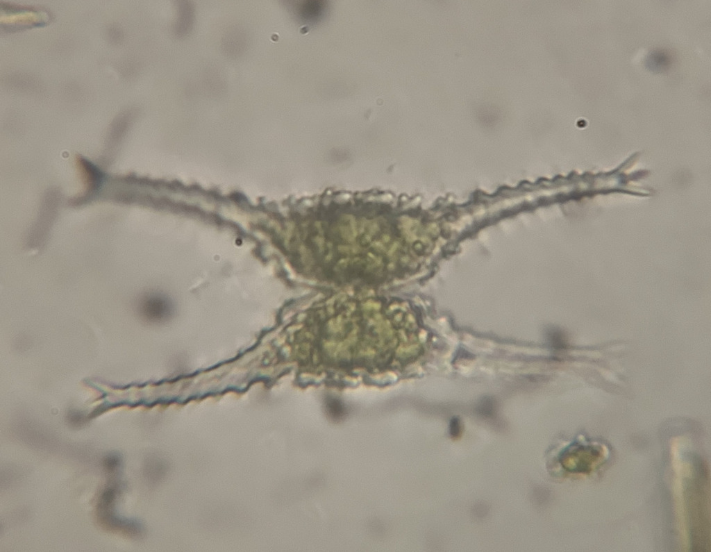 Staurastrum brachioprominens
