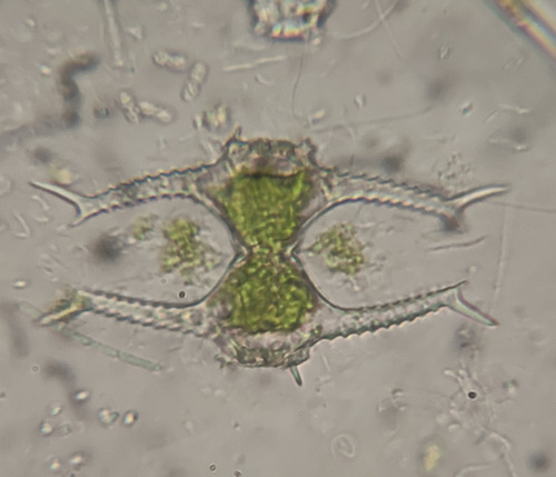 Staurastrum grallatorium var. forcipigerum