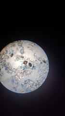 Synchytrium endobioticum