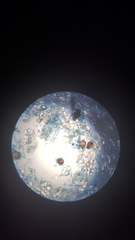 Synchytrium endobioticum