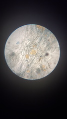 Mucor mucedo