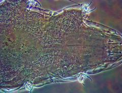 Milnesium cassandrae