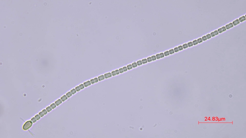 Cronbergia