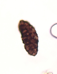 Berkleasmium conglobatum