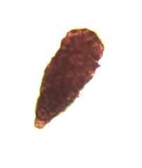 Berkleasmium conglobatum