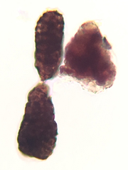 Berkleasmium conglobatum