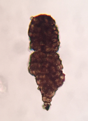 Berkleasmium conglobatum