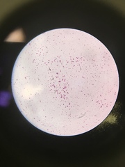 Staphylococcus aureus
