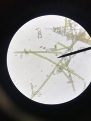 Cercozoa
