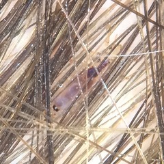 Pediculus humanus capitis