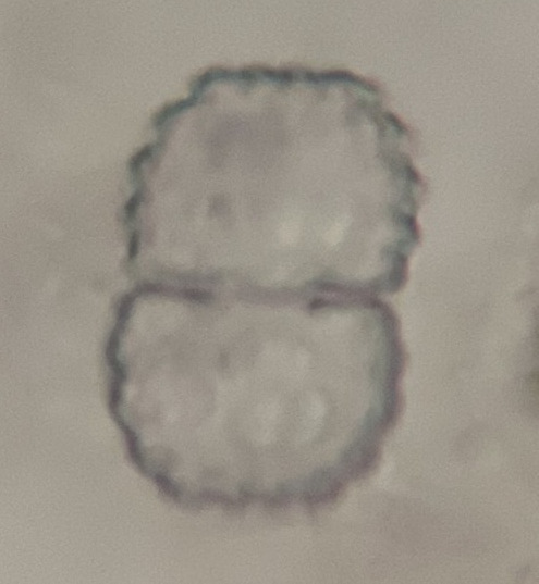 Cosmarium inaequalinotatum