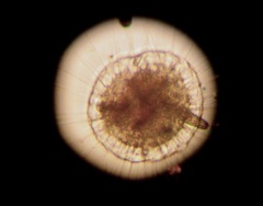 Actinosphaerium