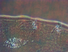 Milnesium cassandrae