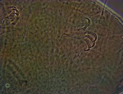 Echiniscus manuelae
