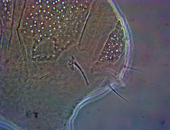 Echiniscus manuelae