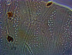 Echiniscus manuelae