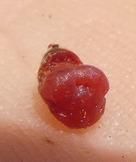 Cylindrococcus spiniferus