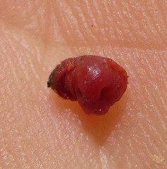 Cylindrococcus spiniferus