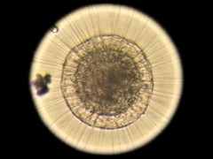 Actinosphaerium