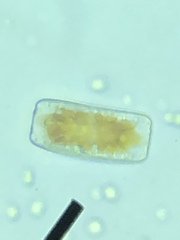Epithemia