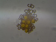 Dolichospermum lemmermannii