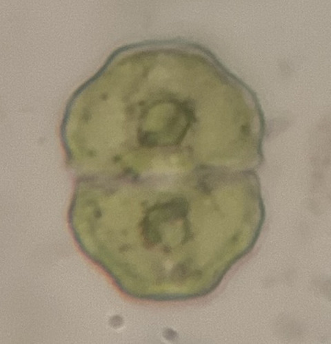 Cosmarium pseudoretusum
