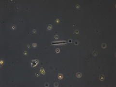 Protozoa