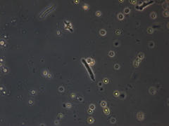 Protozoa
