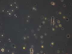 Protozoa